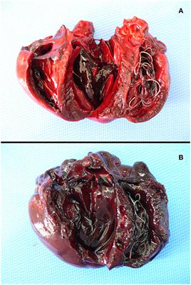 Heartworm Disease (Dirofilaria immitis) in Two Roaming Dogs From the Urban Area of Castel Volturno, Southern Italy